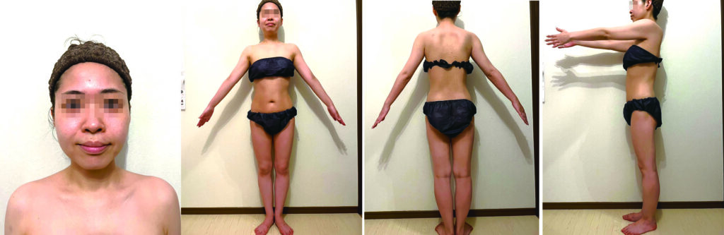 ダイエットアフター