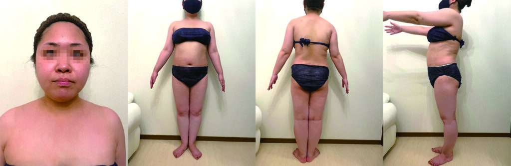 ダイエットビフォー